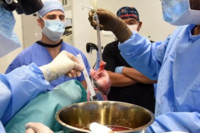 US surgeons perform world’s 2nd pig heart transplant in bid to save dying man